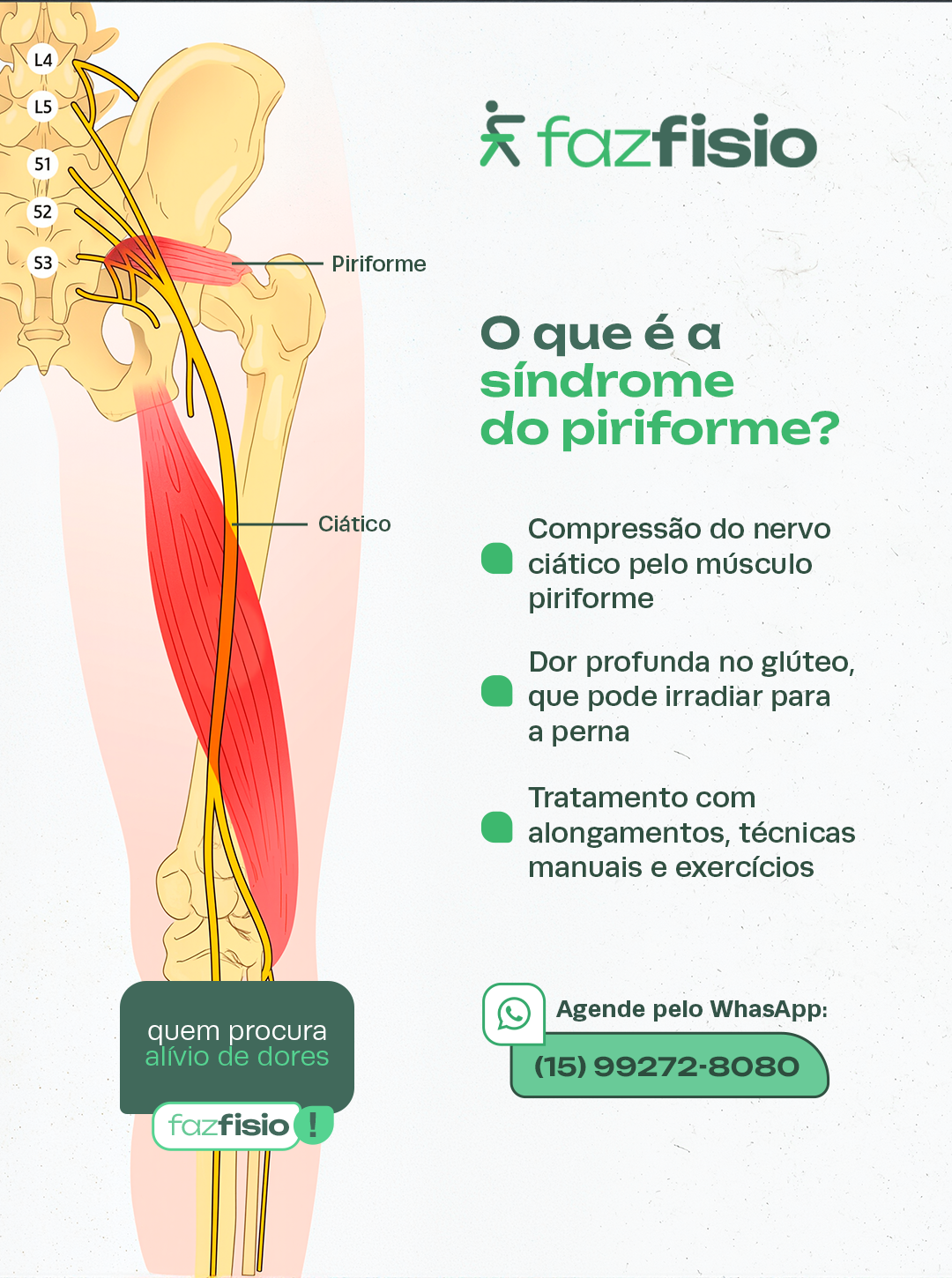 O que é a síndrome do piriforme: compressão do nervo ciático pelo músculo piriforme, dor profunda no glúteo e tratamento com alongamentos, técnicas manuais e exercícios.